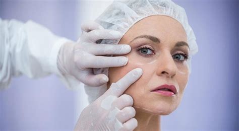 What To Expect Through Facelift Surgery And Complications? - Influencive