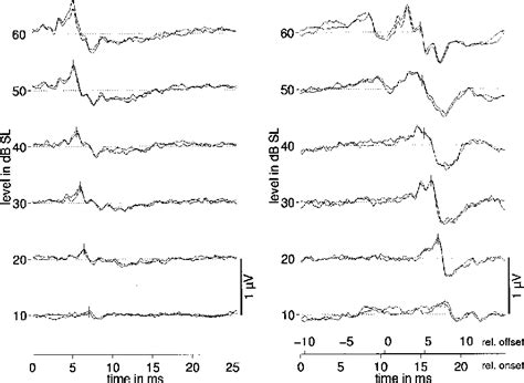 Auditory Brainstem Responses | Semantic Scholar