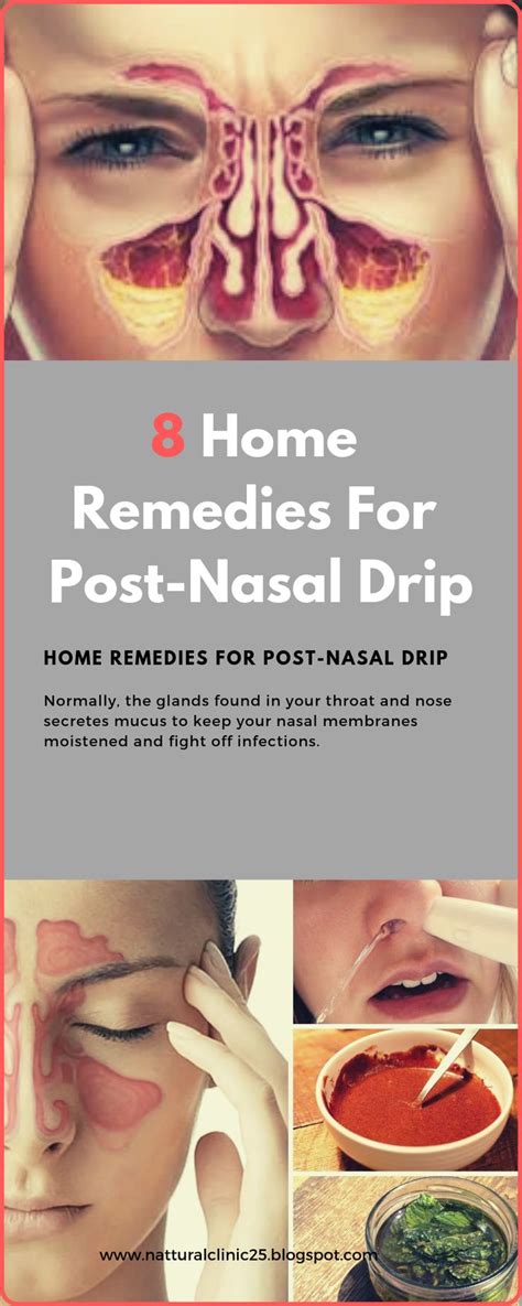 8 Home Remedies For Post-Nasal Drip | Remedies, Herbal medicine, Herbalism