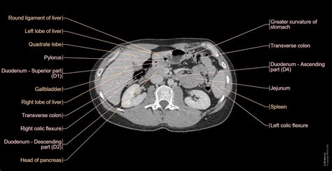 Normal Ct Scan Abdomen