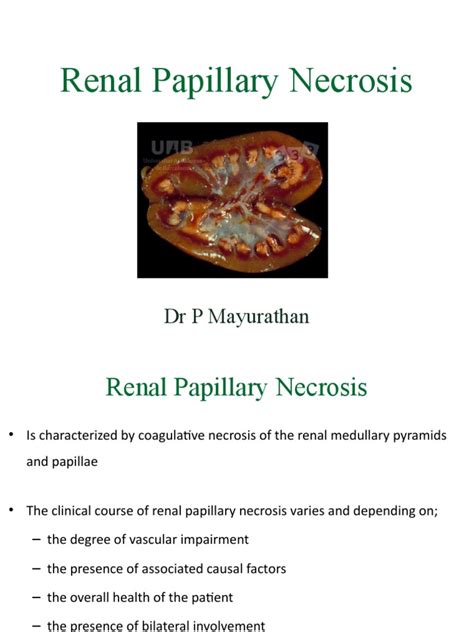 Renal Papillary Necrosis: Causes, Pathophysiology, Clinical Features, and Management | PDF ...