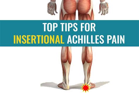 Top tips for insertional Achilles tendinopathy/tendonitis | Treat My Achilles