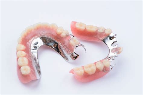 Partial Dentures - Piedmont Dental Associates