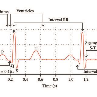 A normal electrocardiogram [2]. | Download Scientific Diagram