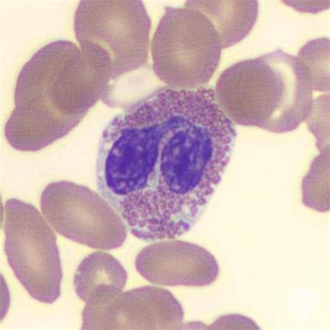 Eosinophil