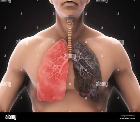 Healthy Lung and Smokers Lung Stock Photo - Alamy