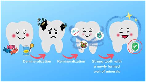 What You Need to Know About Dental Caries and How to Prevent This Disease · Frontiers for Young ...