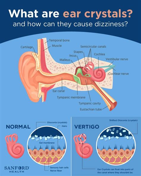 Understanding Dizziness and Vertigo: Causes, Symptoms, and Management ...