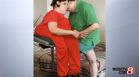 Oldest living conjoined twins, Lori and George Schappell, die at 62 ...