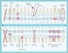 Dental+Charting+Form | Dental Humor | Pinterest | Dental, Dental for ...