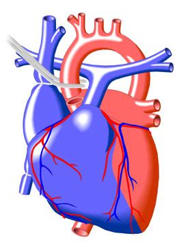 Cardiac Transplant | Congenital Heart Disease - Cove Point Foundation | Johns Hopkins Children's ...