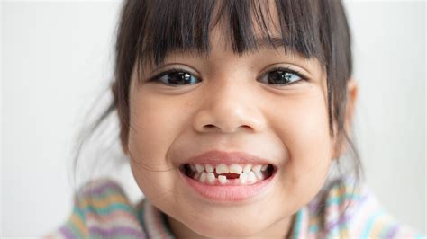 Children's Hypodontia Treatment Singapore | TEETH Paediatric