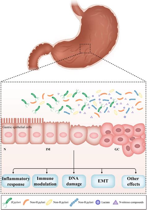 Frontiers | Role of the Gastric Microbiome in Gastric Cancer: From ...