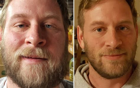 Amazing pictures showing how giving up alcohol transforms your looks ...