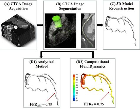 Enhancements in clinical methods to better diagnose coronary artery ...