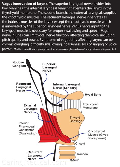 Vagus Nerve related Laryngeal - Laryngotracheal stenosis - Problems of the voice