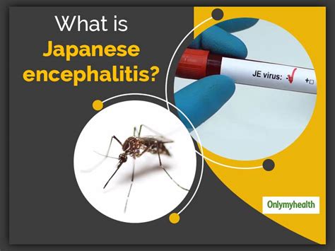 Japanese Encephalitis: Treatment, Procedure, Prevention And Side ...