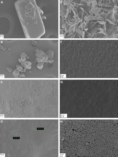 Full article: Development of transmucosal patch loaded with anesthetic ...