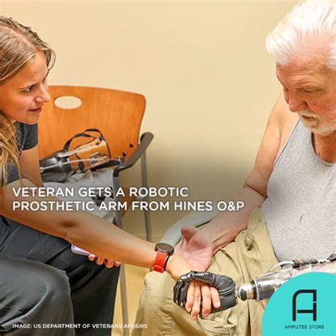 Veteran Gets A Robotic Prosthetic Arm from Hines O&P | Amputee Store