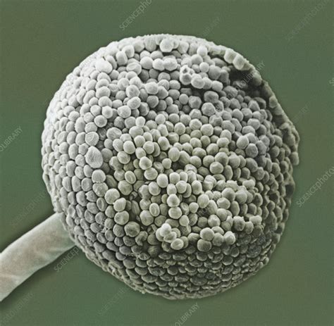 Spores on the sporangium of Bread Mold - Stock Image - C005/8351 - Science Photo Library