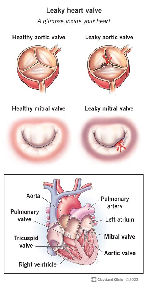 Heart Valves Location