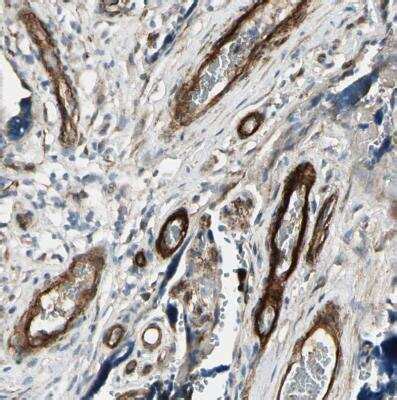 MCAM/CD146 Antibody (NBP1-88132): Novus Biologicals