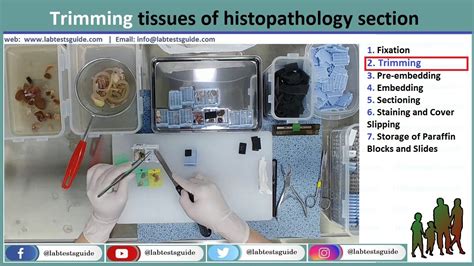 Histopathology test list Archives - Lab Tests Guide