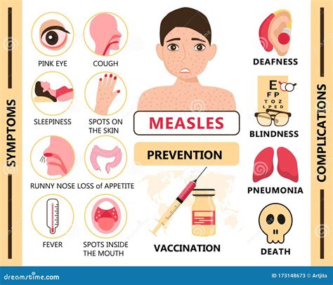 Measles Infographic Concept Vector. Infected Human with Papules on the ...