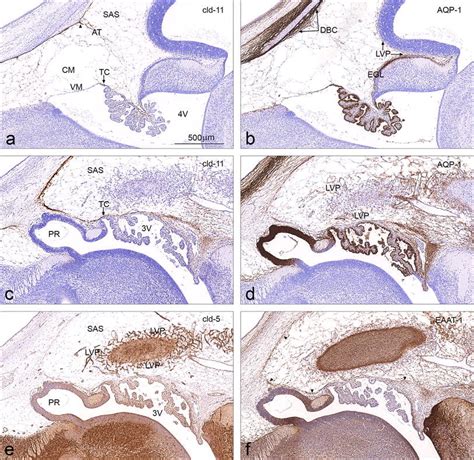 Immunocytochemistry of the leptomeninges in the developing rat brain at... | Download Scientific ...