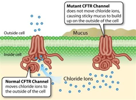 Cystic Fibrosis – Decode Genomics