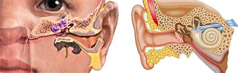 Ear Disease - Dearborn ENT - Livonia - Otolaryngology