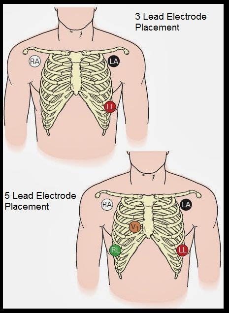 Pin on Nursing