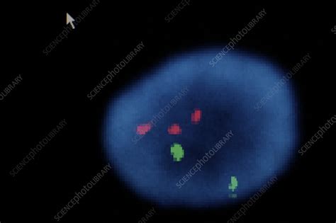 Karyotype analysis - Stock Image - C058/6161 - Science Photo Library