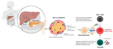 Immune Mediated Diabetes