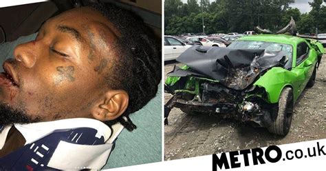 Offset 'could have died' in car crash as he shows off bloody injuries ...