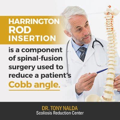 Harrington Rod for Scoliosis: Surgery, Issues, and More