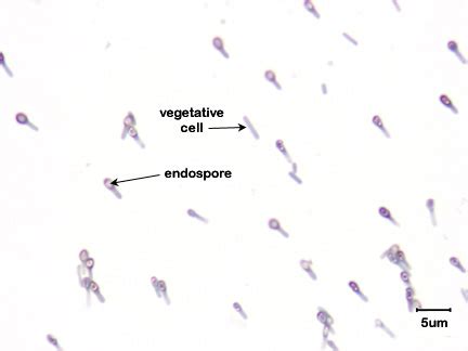 BIOL 230 Lab Manual: Endospore Stain of Clostridium tetani