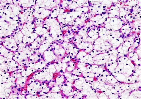 Types Of Hematoxylin Eosin Stain - Beth Mulholland Bruidstaart