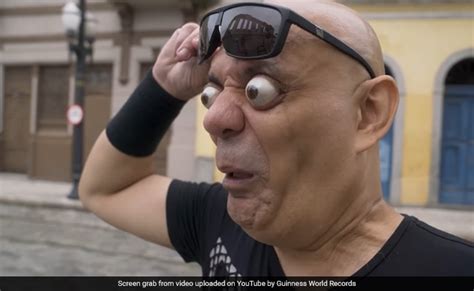 Watch: Man Sets Guinness Record For The Farthest Eyeball Pop Ever