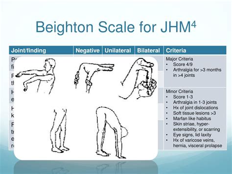 beighton scale chart Beighton score syndrome danlos ehlers hypermobility system marfan scale eds ...