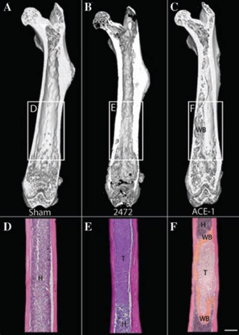 Bone cancer pain. - Abstract - Europe PMC