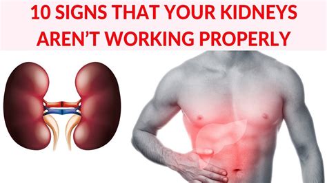 What To Do When Kidneys Are Not Working Properly at Gary Johnson blog