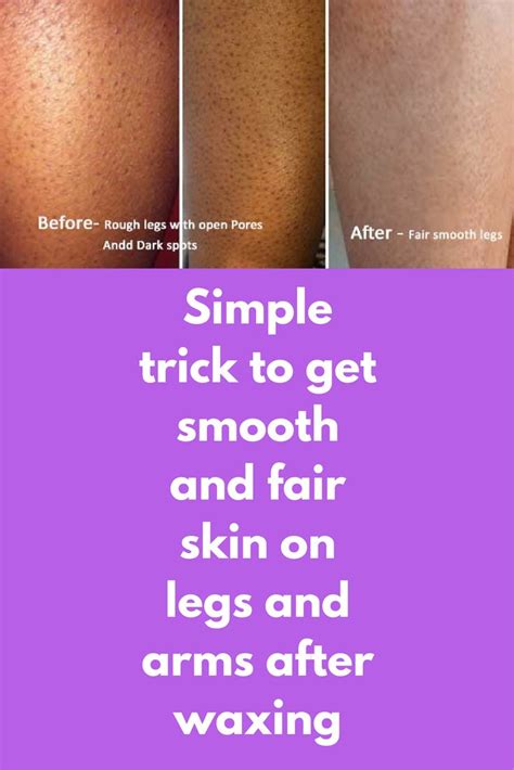 Simple trick to get smooth and fair skin on legs and arms after waxing Waxing pulls out the hair ...
