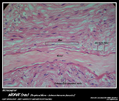 Histology: Nerve Fibers - My Aimst University Lifestyle Blog