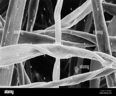 Asbestos Fibers Under Microscope