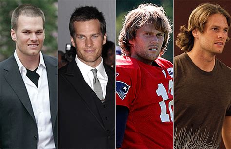 Tom Brady Hair Transplant Rumors | Dr. Rahal