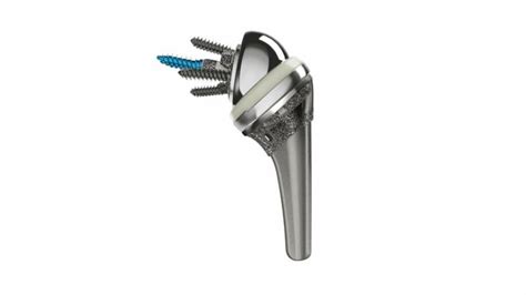 DePuy Synthes INHANCE™ Shoulder System Receives FDA 510(k) Clearance ...