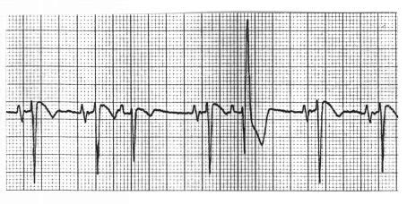 ECG Learning Center - Test