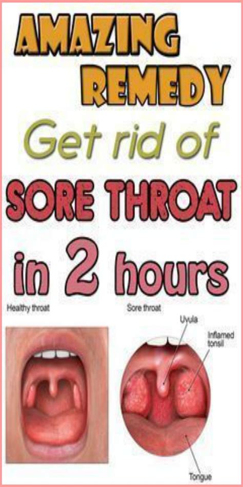 Home Remedies For Sore Throat | Wellness Treats