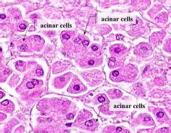 GI 05: Lab - Liver, Gallbladder, Exocrine Pancreas Flashcards - Cram.com